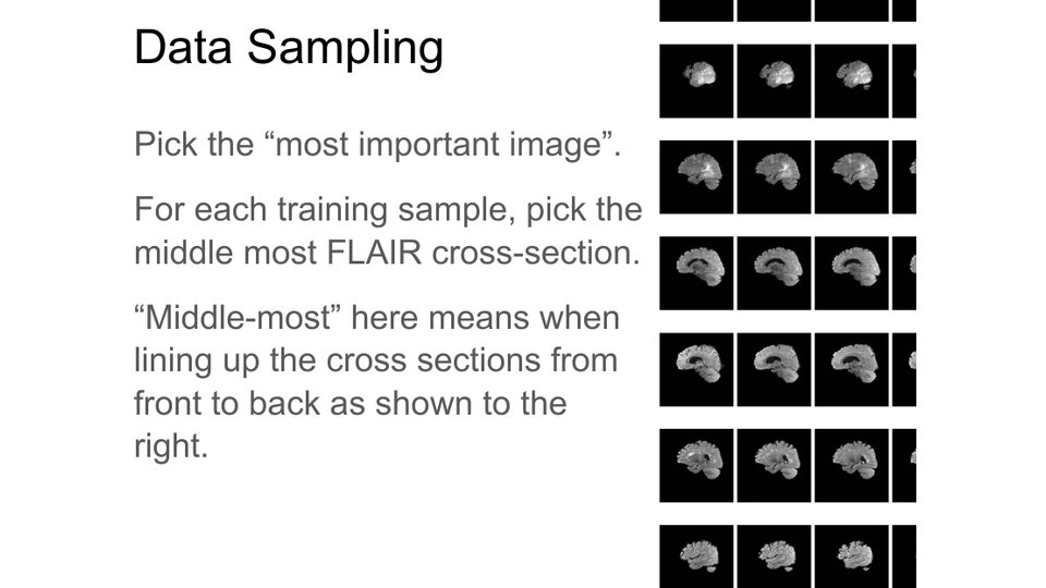 MGMT CNN MRI sampling preview
